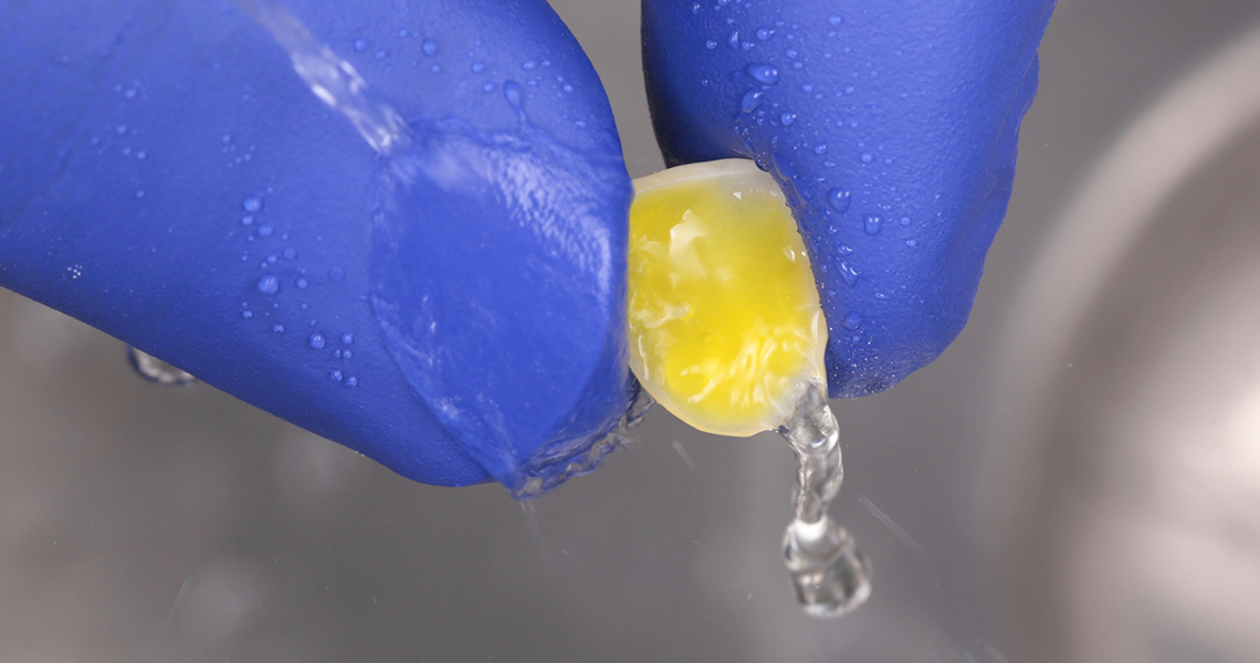 Prozess bei einer dentalen Veneer Behandlung Prozess bei einer dentalen Veneer Behandlung