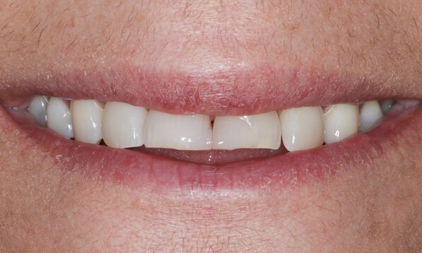 Ausgangssituation: Lächeln der Patientin