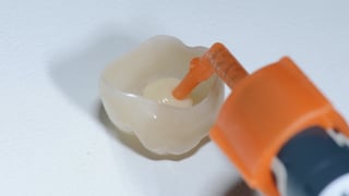 Applikation von 3M™ RelyX™ Applikation von 3M™ RelyX™
