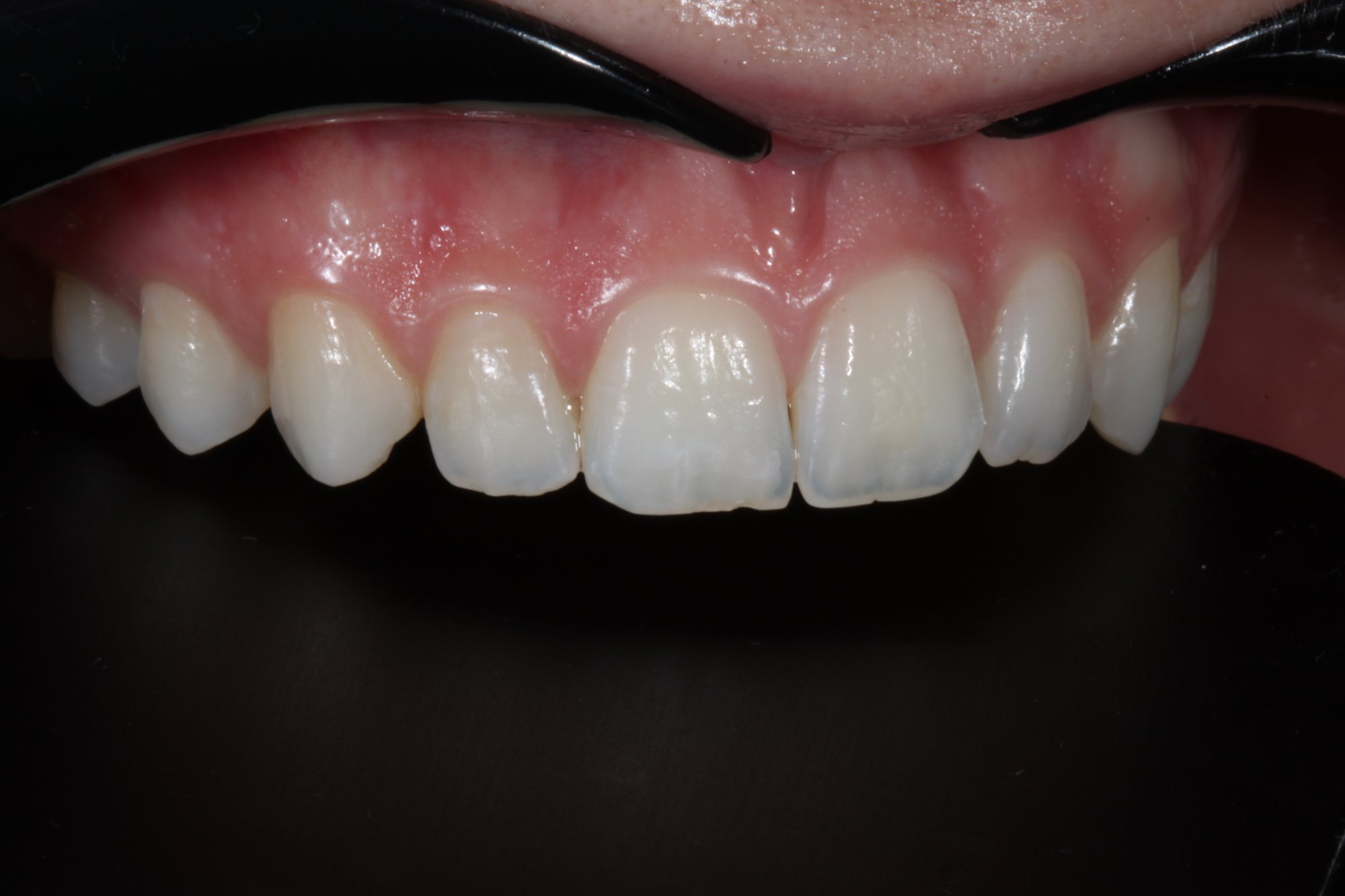 Anatomie des Zahnes 12.