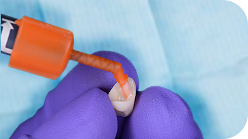 3M™ RelyX™ Universal Mikro-Mischkanüle 3M™ RelyX™ Universal Mikro-Mischkanüle