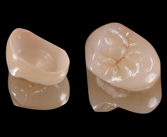Monolithische Zirkoniumoxid-Krone aus zwei Ansichten. Monolithische Zirkoniumoxid-Krone aus zwei Ansichten.